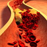 تحليل وفحوصات التسرب الوريدي بمعامل الدكتور محمد خضر بكفر الشيخ