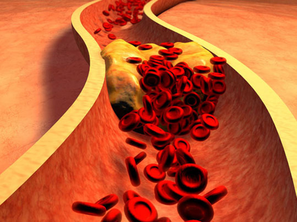 تحليل وفحوصات التسرب الوريدي بمعامل الدكتور محمد خضر بكفر الشيخ